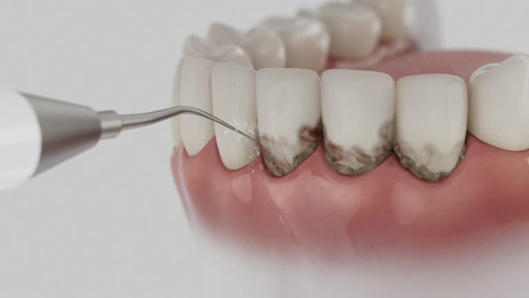 Trusted Emergency Dentist service in Castlewood, VA - Dentist Open Now